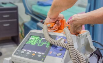 Ce trebuie să ştii despre fibrilaţia atrială Ce trebuie să ştii despre fibrilaţia atrială
