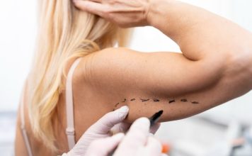 Ce presupune o liposucție și când se recomandă?